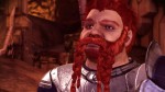Dragon Age: Origins Sells 3.2 Million